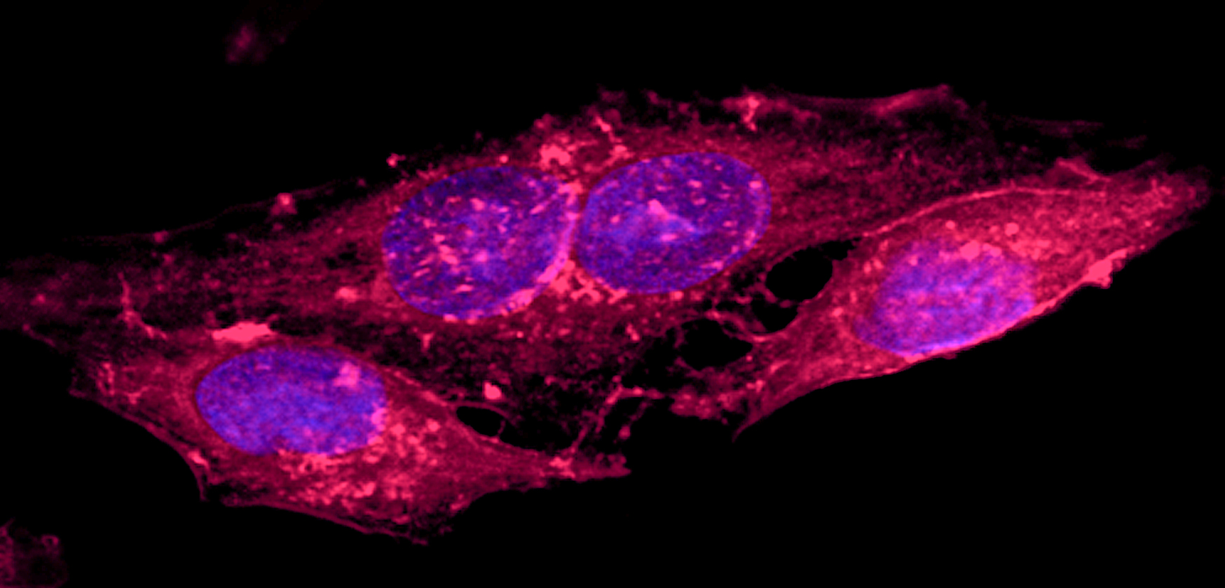 HeLa Crab (acquired Ross Fluorescence Imaging Center by Prof. Jim Potter)